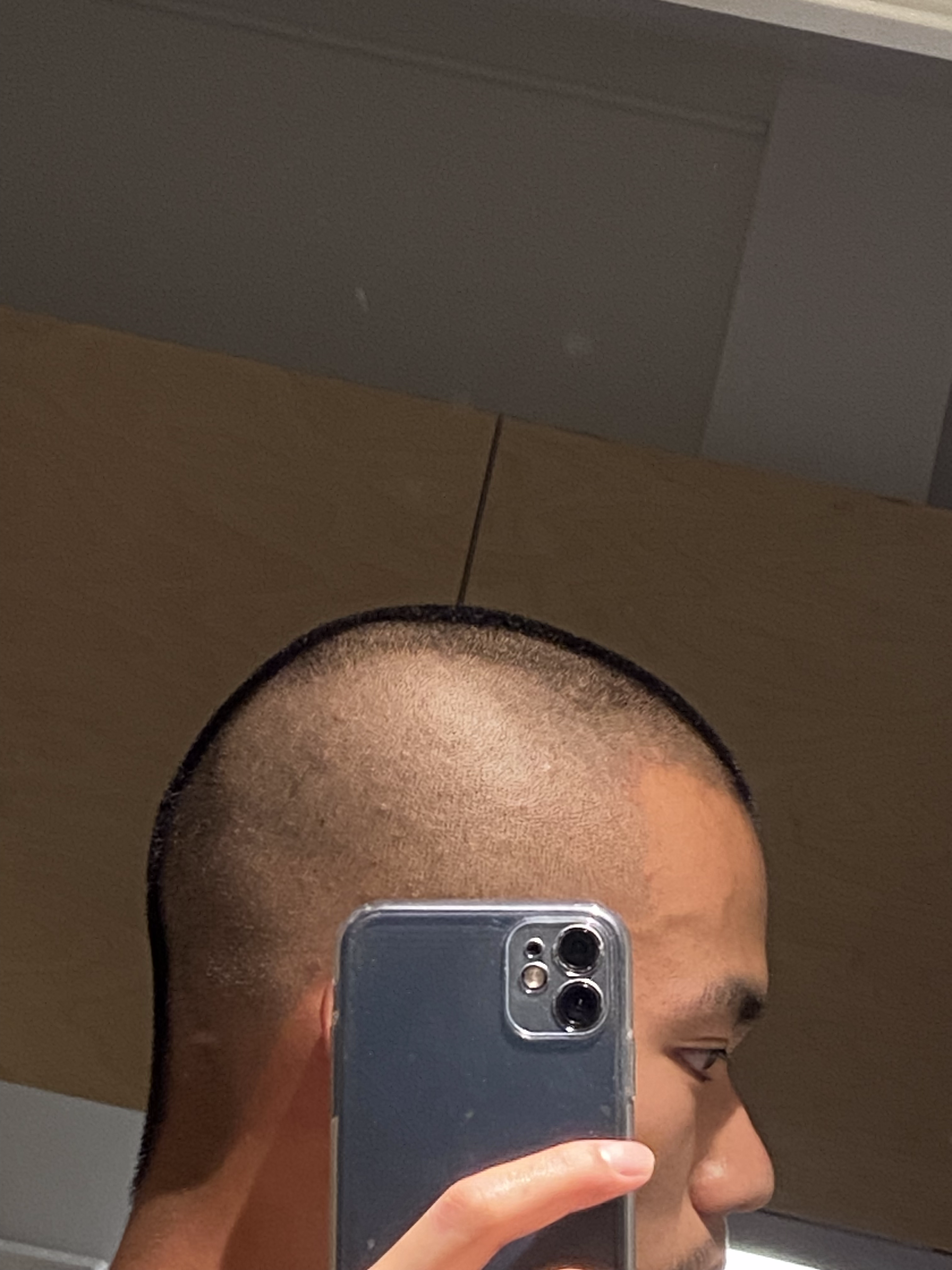 hairs_3