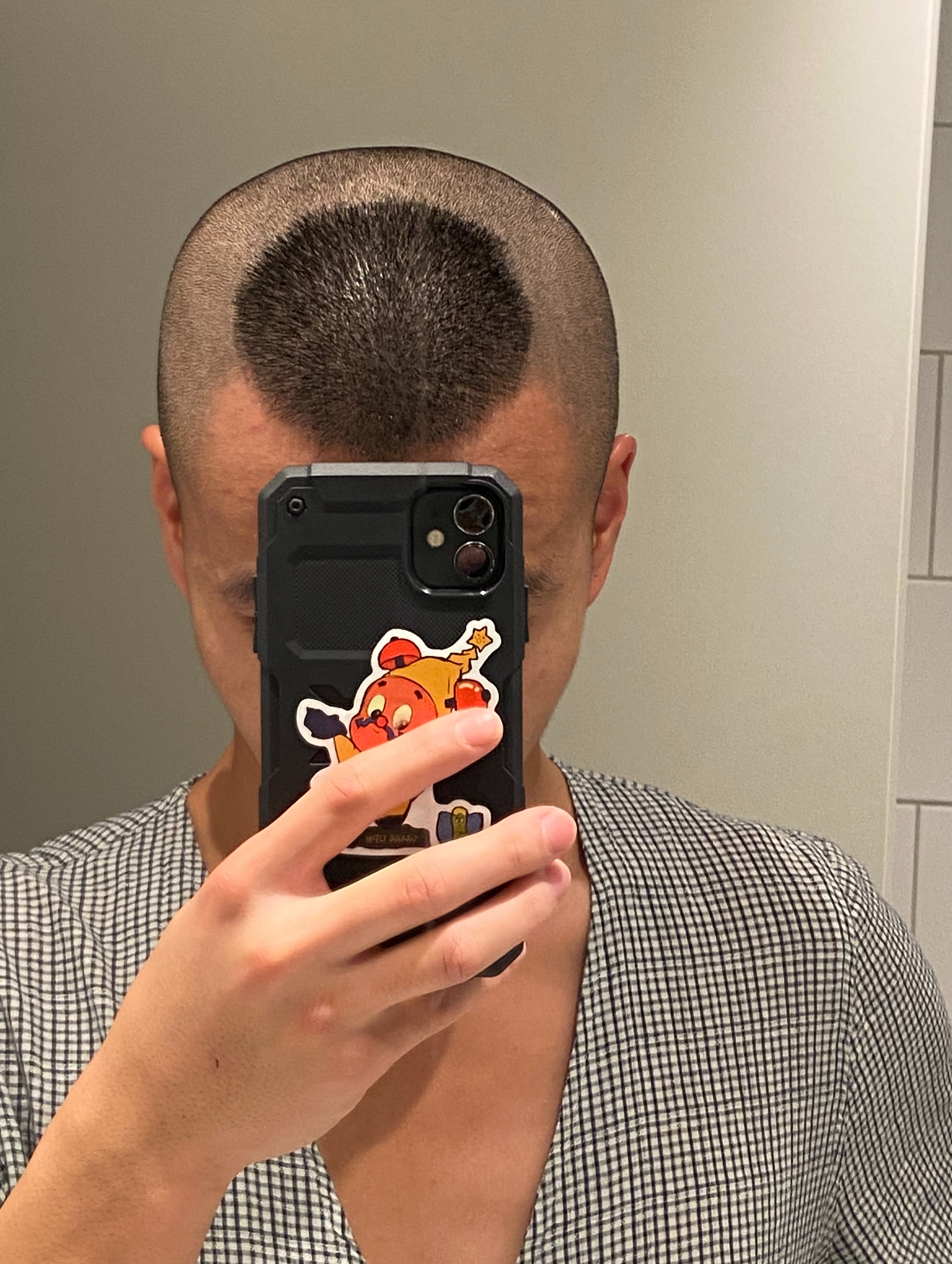 hairs_5